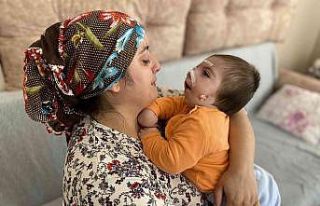 Doğuştan goldenhar sendromlu bebeklerinin sağlığına...