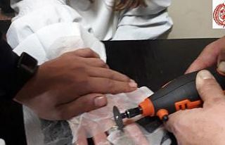 Parmağına sıkışan yüzüğü itfaiye çıkardı.