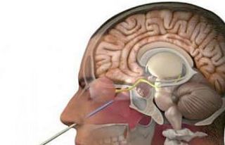 Yalova’da İlk kez Özel Atakent Hastanesi’nde...