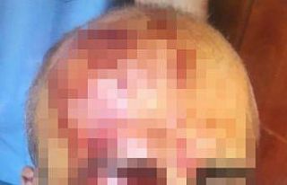 Orman muhafaza memurunu darbeden 4 şüpheli gözaltına...