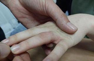 15 yaşındaki gencin parmağına sıkışan yüzüğü...