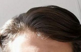 Hayvan otlatırken üzerine yıldırım düşen genç...