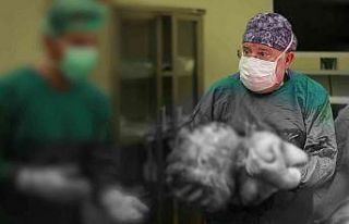 Kadın hastanın karnından 16,9 kiloluk dev kitle...