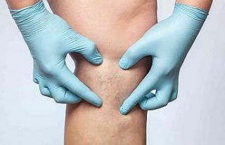 Thermoblock ile kılcal damarlarınızdan anında...