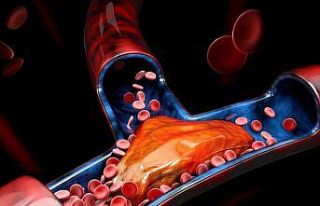 Venöz tromboembolizm nedeniyle her 37 saniyede bir...