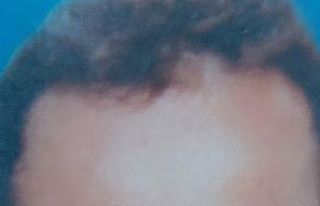 Balkonda düşen şahıs hayatını kaybetti