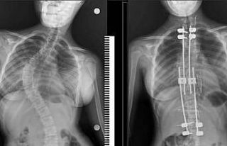 500 bin liralık ameliyatı 1 kuruş vermeden oldu