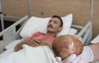 Hastaneye başvuran hastanın mesanesinden 1 kilo...