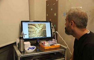 Tatil dönüşü cilt lekeleri ve saç dökülmelerine...