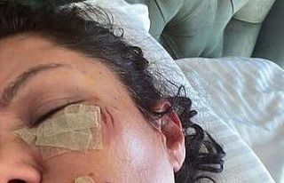 Ünlü şarkıcı Tuğba Altıntop köpek saldırısına...