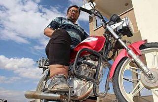 Bacakları her yıl 7 santimetre genişliyor