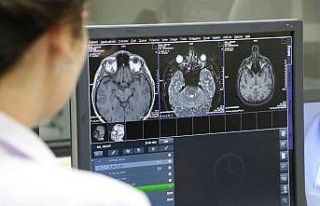 Diyarbakır’da hastalara anestezi eşliğinde MR...