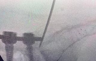 Türk doktor, bulduğu yöntemle literatüre girdi