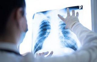 Bu etkenler KOAH’ı tetikliyor