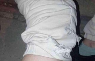 Hamile kadına köpek saldırdı