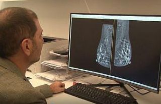Mamografi işlemi ile ilgili efsaneler yeni cihazlarla...