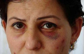 Arabayla takip edilip sokak ortasında darbedilen...