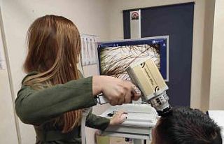 Demir ve vitamin eksikliği kelliğe yol açıyor