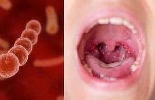 İşgalci şekle bürünen “Streptokok A” bakterisinde...