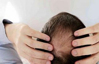 Kök hücre tedavisi ile saç dökülmesini durdurun