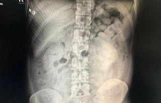 Diyarbakır’da şüpheli yolcunun midesinden 800...