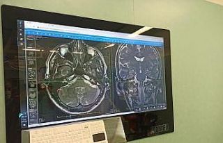 Eskişehir Şehir Hastanesinde ilk yüz felci ameliyatı...