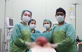 Karabük’te 47 yaşındaki kadından 3 kilo 750...