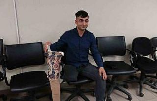 Protez bacağı enkazda kalmıştı, Bolu’da yenisi...