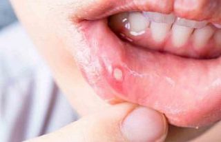 Sık kullanılan ağız gargaraları bu hastalığa...