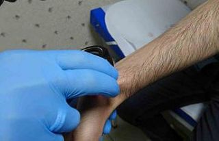 Uzman doktor uyardı: "Uyuz hastalığı Kovid-19...