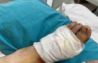 Yemek yaparken dikkat: Kızgın yağ hastanelik etti