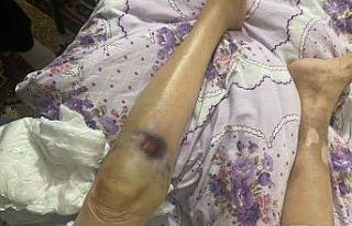 Ankara’da iki ay önce darp edildiği öne sürülen...