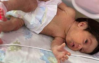 Depremzede Asel bebek, Adana’da hayata tutundu