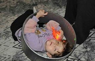 Fraser sendromlu Sevgi Hira, kasnak ve ışık ile...