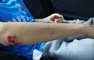 Sahipsiz köpekler hastanelik etti