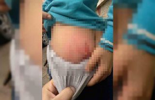 Batman’da köpeklerin saldırısına uğrayan çocuğun...