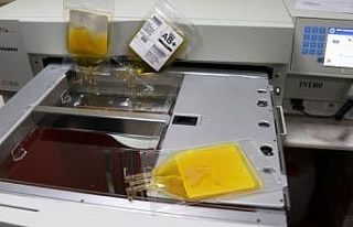 Kızılay’a çağrı: “COVID-19’u ağır geçiren...