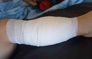 Pitpull cinsi köpeğin saldırdığı 5 yaşındaki...