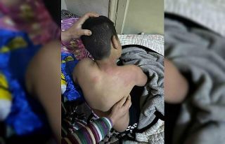 Seçim bürosuna gelen çocuğu kaynar çayla yaktı,...