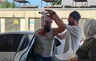 Bursa’da kendini kesen acemi kasap sayısı 462...