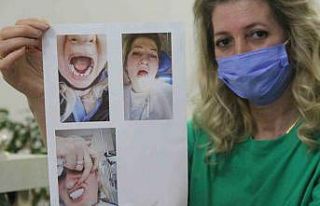 Daha güzel gülmek istedi, yanlış tedavi ile hayatı...