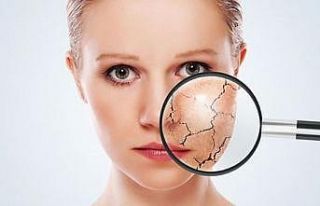 Hava sıcaklıkları artıyor, cilt kuruluğu olanlar...