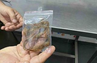 Oyun oynayan kedi 1,5 metrelik kurdele yuttu