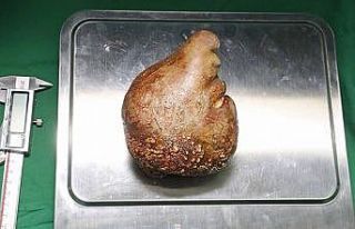 Sri Lanka’da dünya rekoru: 801 gram ağırlığında...