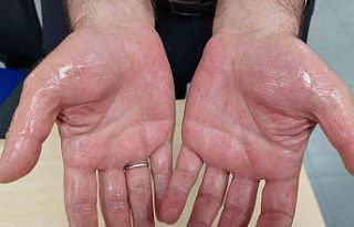 Terlemeye terletmeyen çözüm