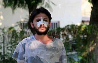 Antalya’da kiracı gence "ucuz kira" dayağı...