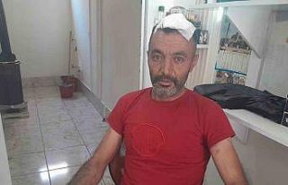 Dükkanının önünü yıkarken başına beton düştü