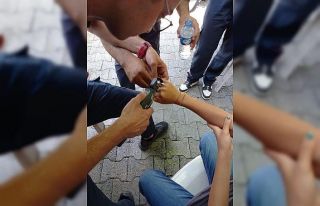 Yüzük çıkmayınca imdada itfaiye ekipleri yetişti