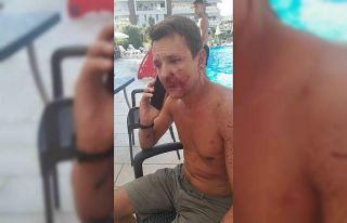 Alanya’da yaşayan Rus’u site yöneticisinin darp...