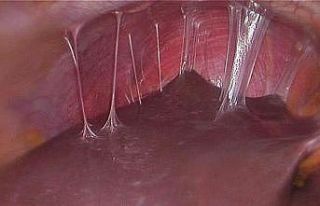 BUÜ’lü akademisyenin projesi “fıtık” oluşumunu...